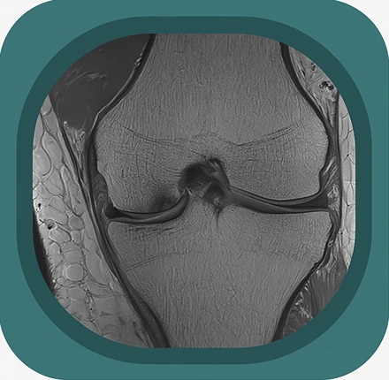 MRI knee ligaments anatomy icon
